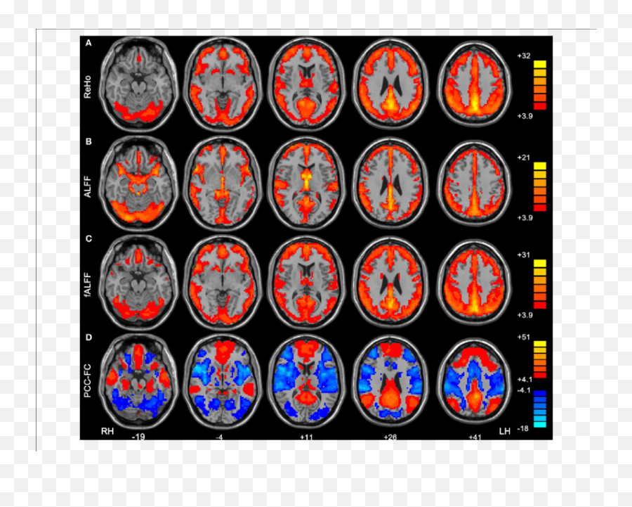 Within - Condition Patterns Of Reho A Alff B Falff C Emoji,Work Emotion Cr Kai Tsx Within - Condition Patterns Of Reho A Alff B Falff C Emoji,Work Emotion Cr Kai Tsx