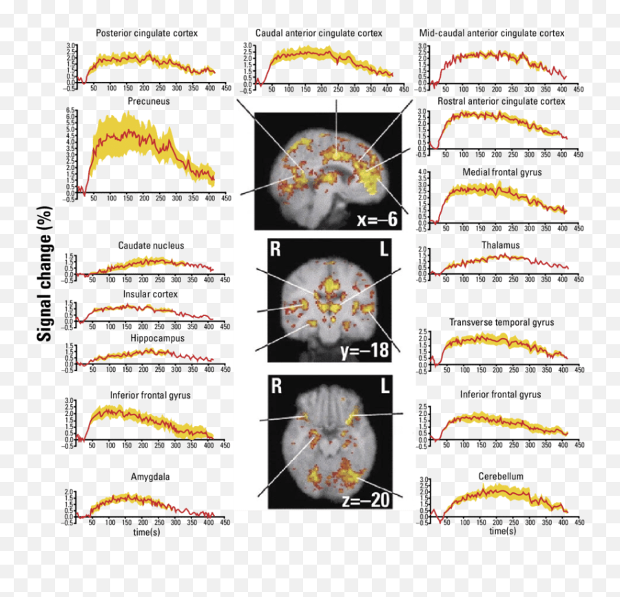 Fmri Activation After Administration Of Reminfentanil A Emoji,The Cognitive Appraisal Theory Of Emotion Khan