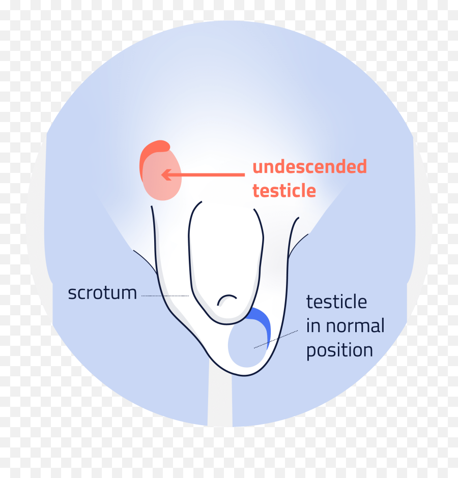 Male Infertility Causes Exseed - Dot Emoji,Testicle Trapped Emotion