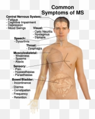 Multiple Sclerosis Specialist Advice - Multiple Sclerosis People With Ms Emoji,Ms And Emotions