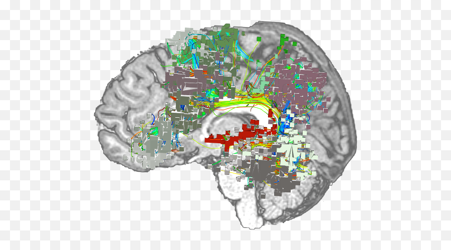 What Is Connectomics - For Adult Emoji,Emotions In Brain Scans