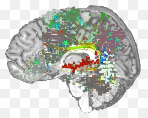 What Is Connectomics - For Adult Emoji,Emotions In Brain Scans