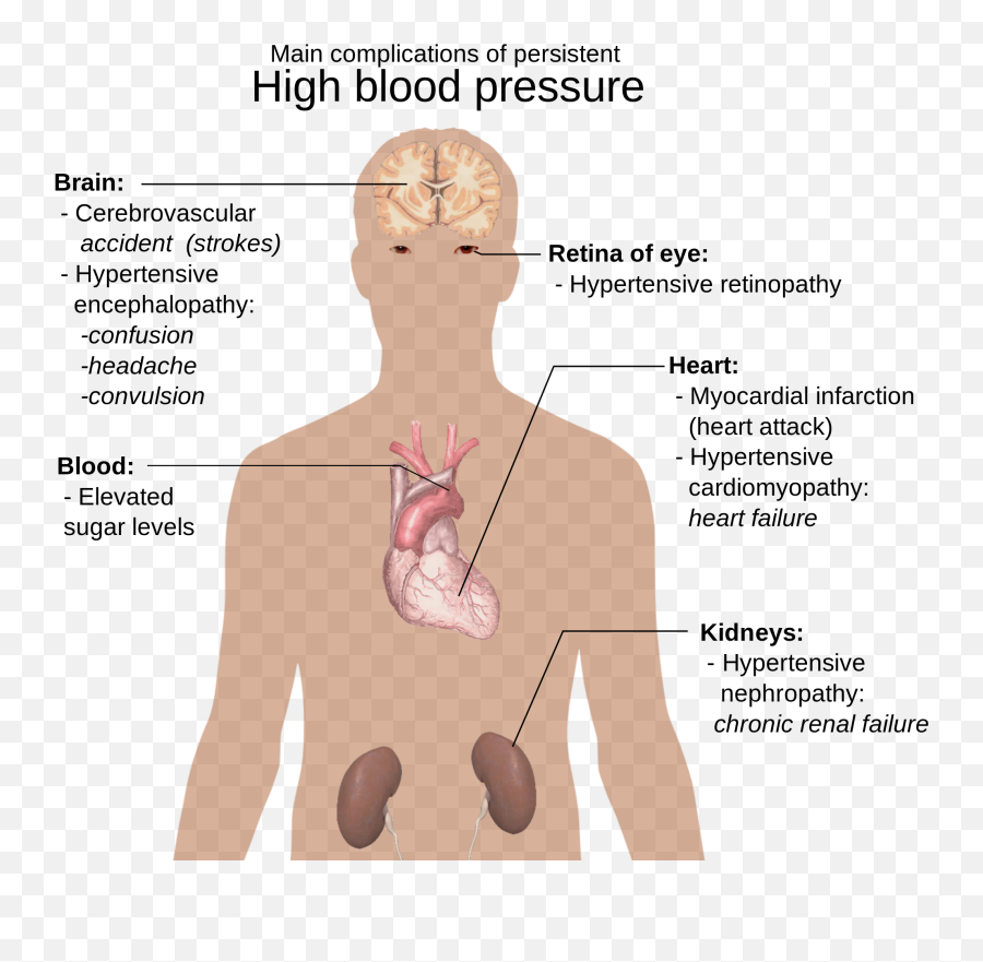 Complications Of High Blood Pressure Free Image Download - Circulatory System High Blood Pressure Emoji,Blood Pressure Emoji