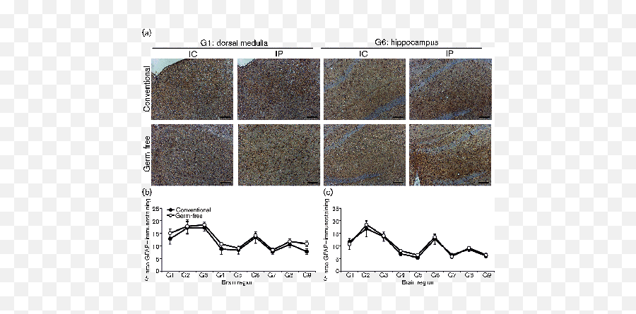Prion Disease Pathogenesis In The Absence Of The Commensal Emoji,Richard Tan 7 Emotions Points Prion Disease Pathogenesis In The Absence Of The Commensal Emoji,Richard Tan 7 Emotions Points