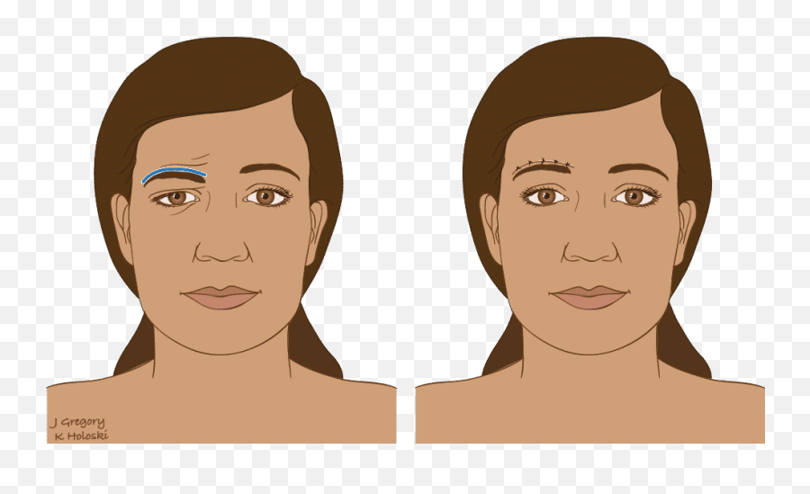 Facial Reanimation U2023 Thanc Guide Emoji,Artists That Focus On Facial Emotion