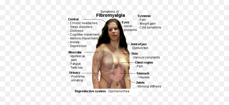 Fibromyalgia - Fibromyalgia Meaning Emoji,Body Pains Related To Emotions