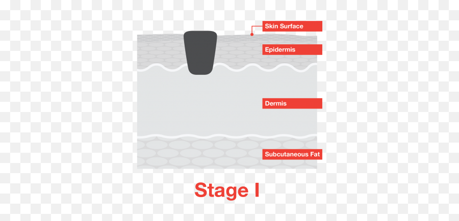 Stage 1 Melanoma - Melanoma Mole Stage 1 Emoji,Wordbrain 2 Emotions And Feelings Level 1