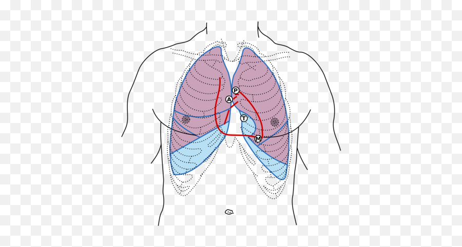 Physical Examination - Textbook Of Cardiology Heart Sounds Lub Dub Emoji,Strong Emotion Felt In Groin