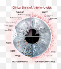 170 Ideas In 2021 - Anterior Uveitis Signs Emoji,Charts Irridology Reflexology Emotions