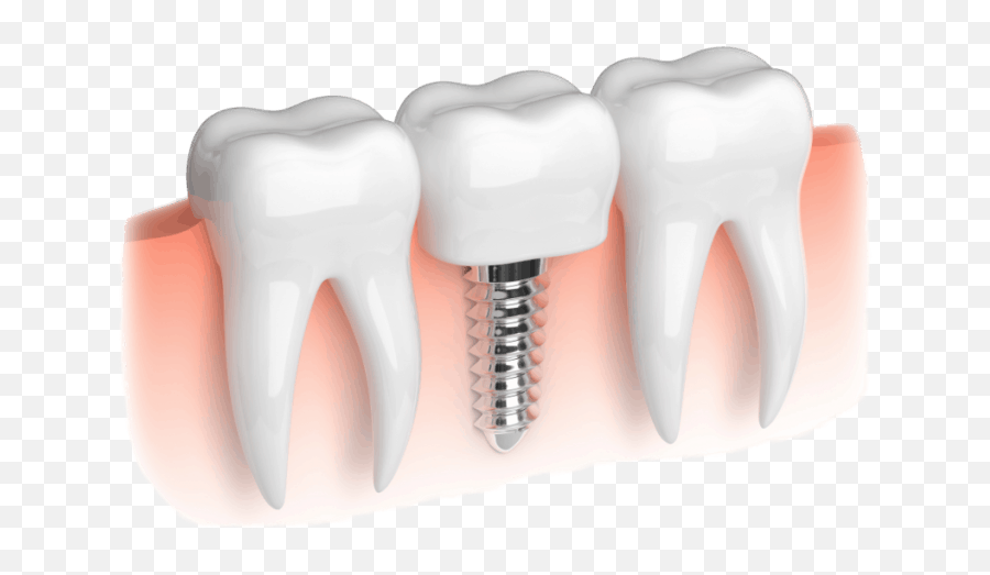 Dental Implant For Missing Teeth - Vertical Emoji,Missing Tooth Emoticon -smiley -emoji