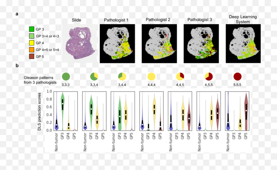 Código Google Novembro 2018 - Machine Learning Prostate Cancer Emoji,Monocle Emoji Samsung