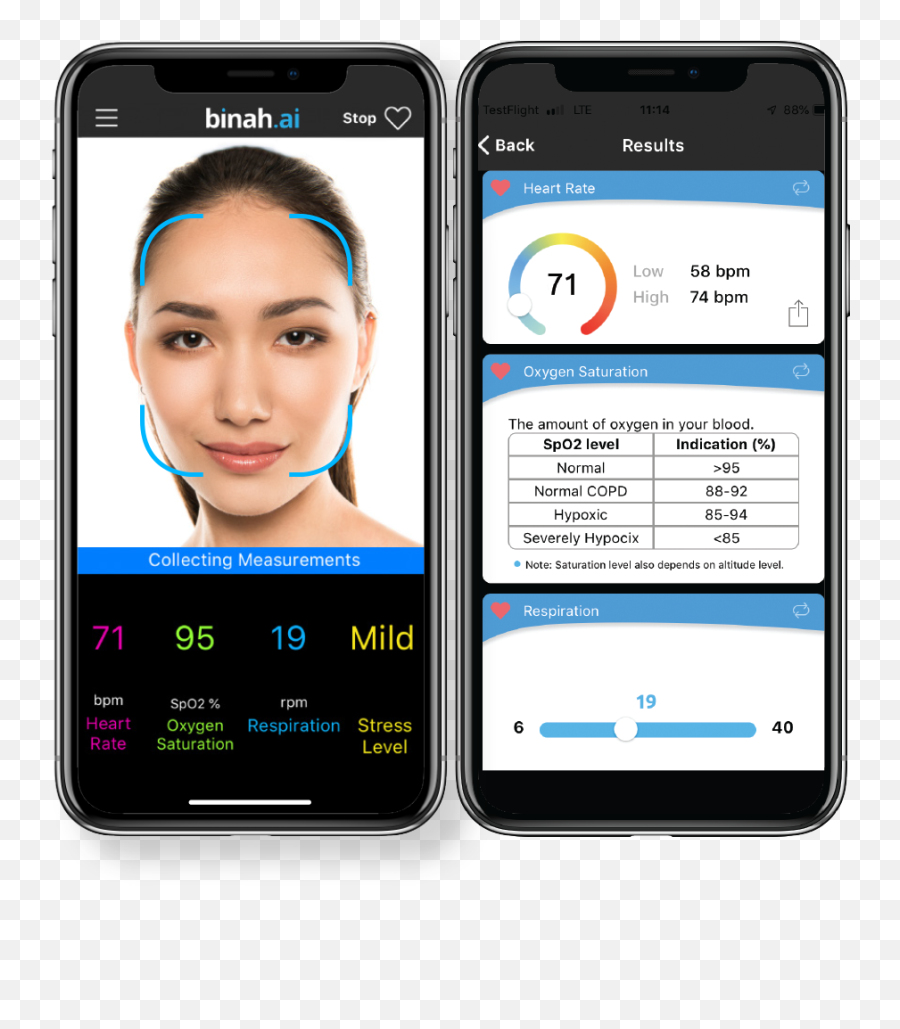 Video Ai Detects Heart Rate And Stress Level Dogtown Media - Binah Ai Emoji,Pulse Rate And Emotions