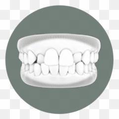 Invisalign - Winter Park Dentistry Dentures Emoji,Mouth Crossed Out Emoji