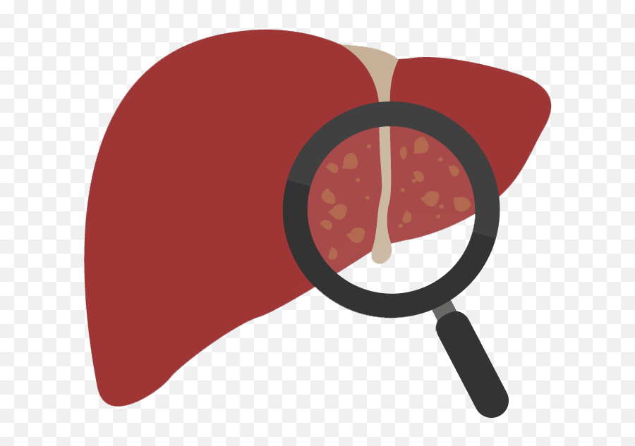 Gallstones In The Liver Clipart - Gallstones Clipart Png Emoji,Liver Emoji