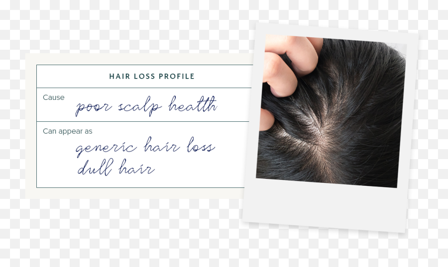 The Most Common Causes Of Female Hair Loss Monpure Uk Emoji,Iron On Patches Emotions
