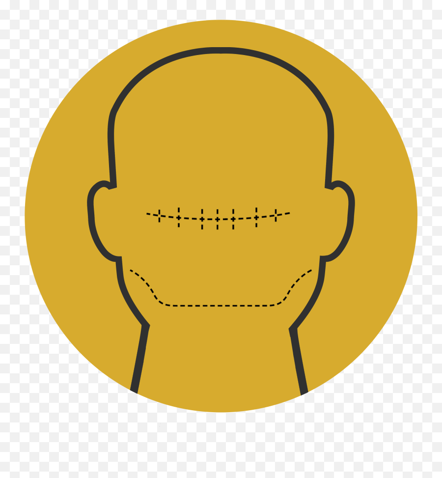Scalp Micropigmentation Hair Clinic Hair Tattoo - Sydney Dot Emoji,Mastering Your Emotions Bald Guy