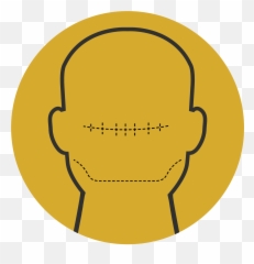 Scalp Micropigmentation Hair Clinic Hair Tattoo - Sydney Dot Emoji,Mastering Your Emotions Bald Guy