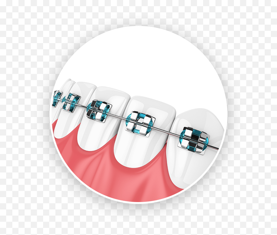 Traditional Metal Braces Brackets Ligatures Emoji,Sucking Teeth Emoji