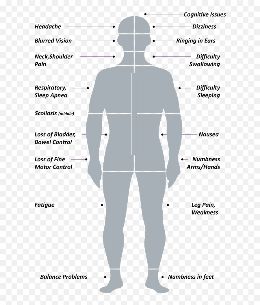 The Chiari Experience - Standing Emoji,Emotion Hot Cognition Cold Cognition