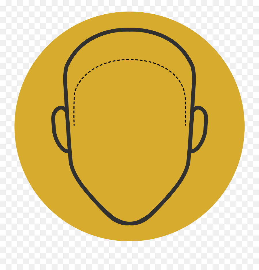 Scalp Micropigmentation Hair Clinic Hair Tattoo - Sydney Dot Emoji,Mastering Your Emotions Bald Guy