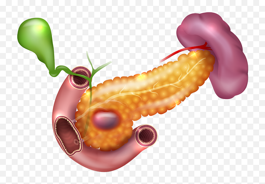 Darkspots In Pancreas - Uncinate Process Emoji,Liver Emoji