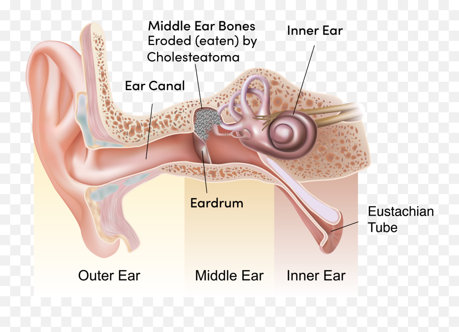 Cholesteatoma U2014 Chad Ruffin Md Emoji,Plucheck Weal Of Emotions