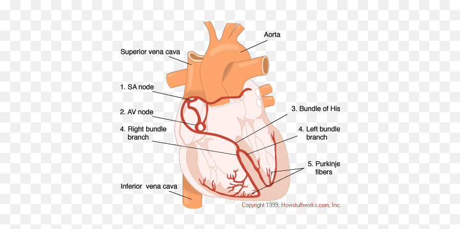 Normal Electrical Impulse Of The Heart - Slide Share Emoji,Schematic Comparison Of Theories Of Emotion Mcat Psychology