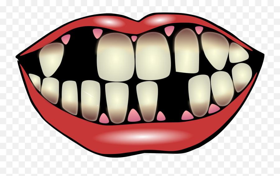 Dental Clipart Lost Tooth Dental Lost - Missing Teeth Clipart Emoji,Missing Tooth Emoji