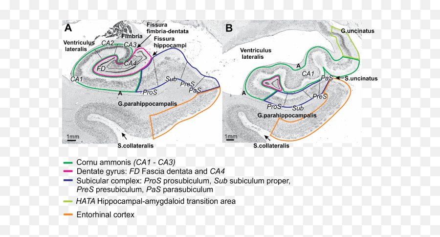 Clinmed International Library Advances In - Hippocampus Cytoarchitecture Emoji,Body Emotion Mapping