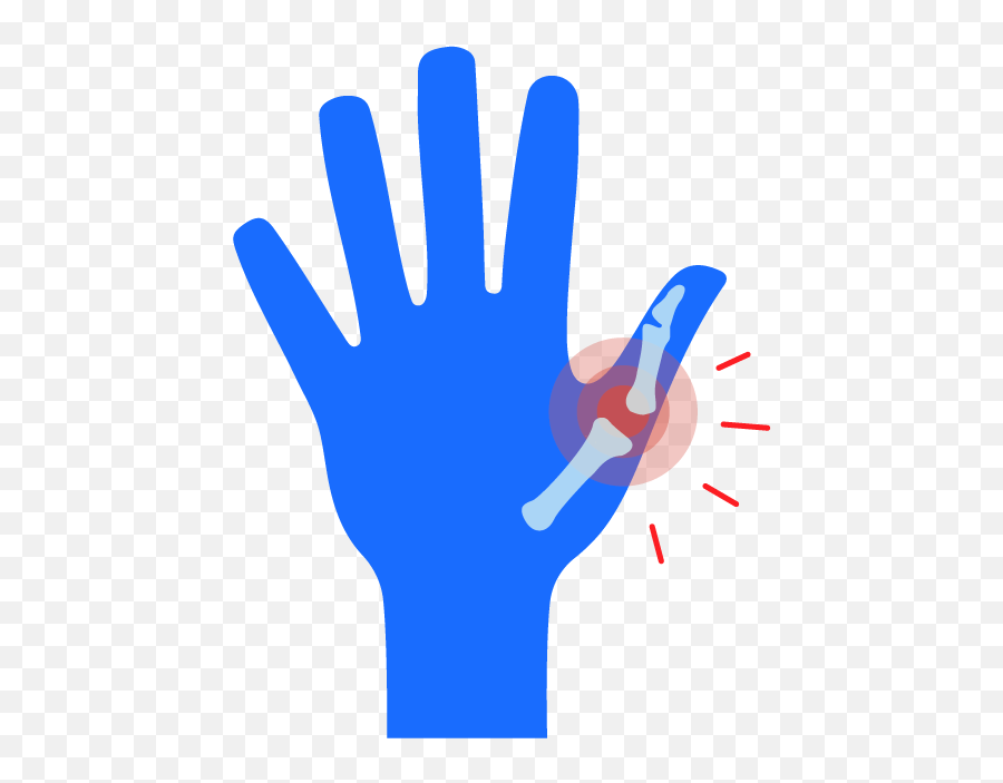 Sprained Thumb When To See A Doctor U0026 Tips For Recovery Buoy - Jammed Thumb Emoji,Large Wave Bye Bye Gif Emoji