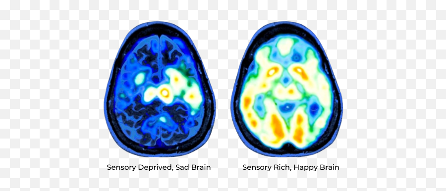 Reclaimed Brain - Cerebro De Una Persona Deprimida Emoji,Ideo Shawn Achor Positive Emotions)