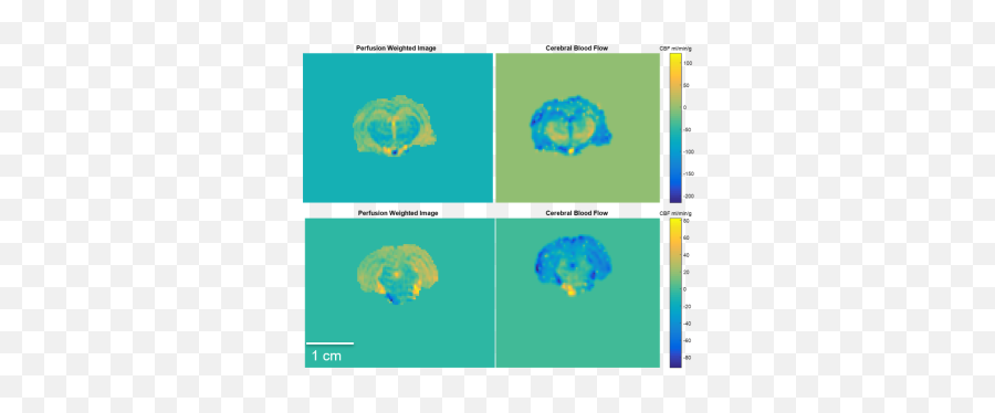 Ismrm20 Digital Posters Page Neuro High Field Head Neck - Vertical Emoji,How Do You Show The Emotion Spells For Tibia