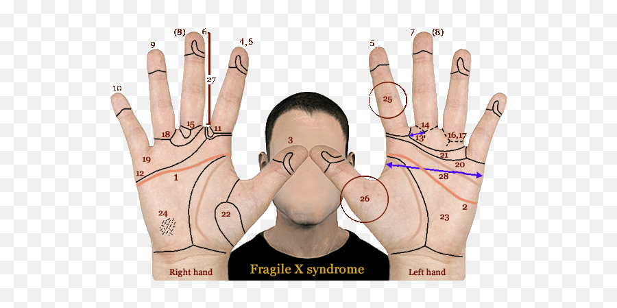 1 Hand Chart For Neuroticism Vs - Cara Con Signo De Pregunta Emoji,Reflecology Chart Emotions Hands