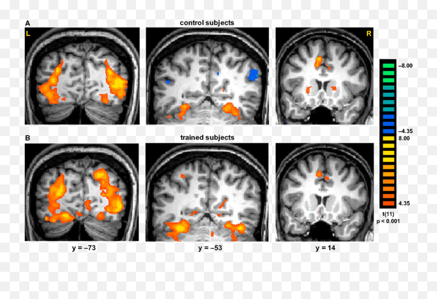Frontiers Training Facilitates Object Recognition In - Object Recognition Mri Emoji,Cubism Emotion