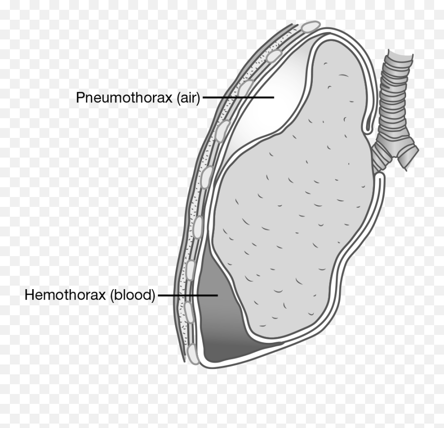 Pulmonary System - Dot Emoji,Og Abel Mask To Hide Emotions