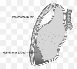Pulmonary System - Dot Emoji,Og Abel Mask To Hide Emotions