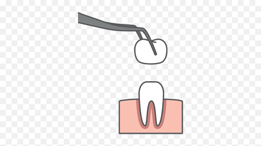 Restorative Dentistry In Richmond Tx - Westpark Pediatric Stainless Steel Crown Png Emoji,Will Ferrel Emotion