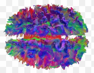 Its All In My Head - High Definition Fibre Tracking Emoji,Surgery Cut Open Brain And No Emotion