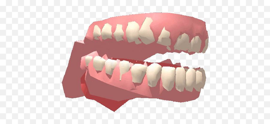 Broken Chattering Teeth - Biting Gif Transparent Emoji,Chattering Teeth Emoji