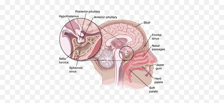 Surgery For Pituitary Tumors - Sinuses And Pineal Gland Emoji,Surgery Cut Open Brain And No Emotion