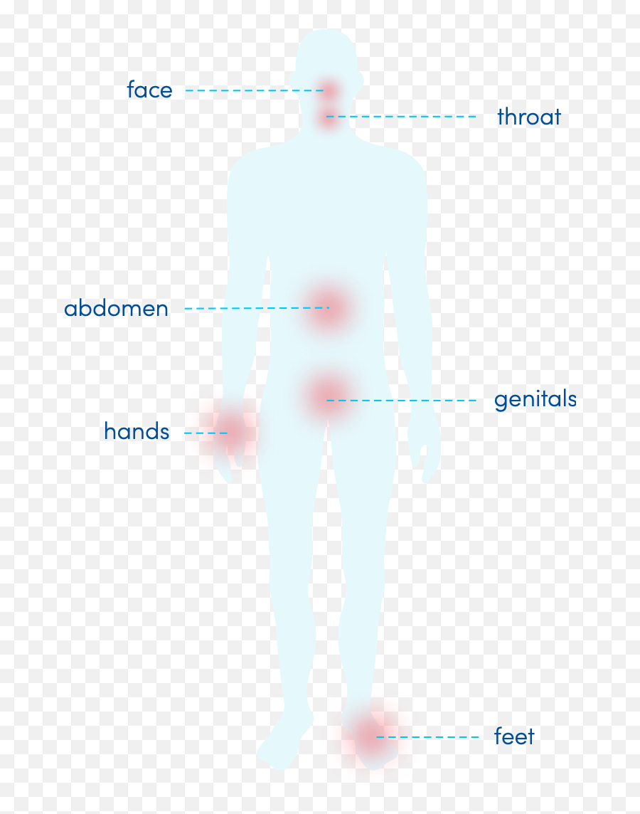 Knowhae - Angioedema Most Common Areas Emoji,Upsr Swelling Of Emotion