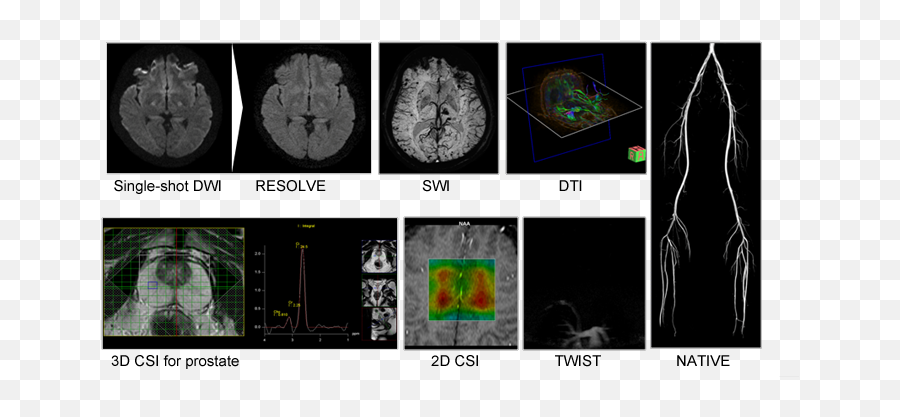 Index Of Images - Computed Tomography Emoji,Tomografo Siemens Somatom Emotion 16