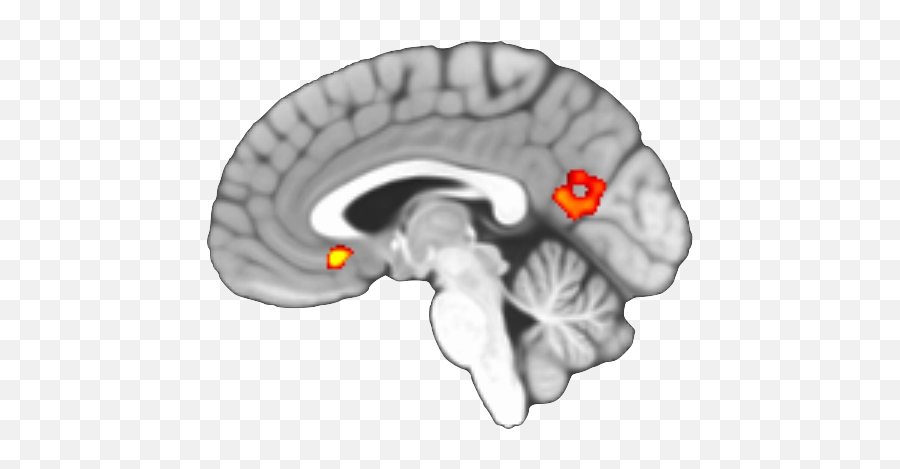 Alcohol And Cannabis Use And Disruption In Processing Emoji,Kids In Hospitals Emotions