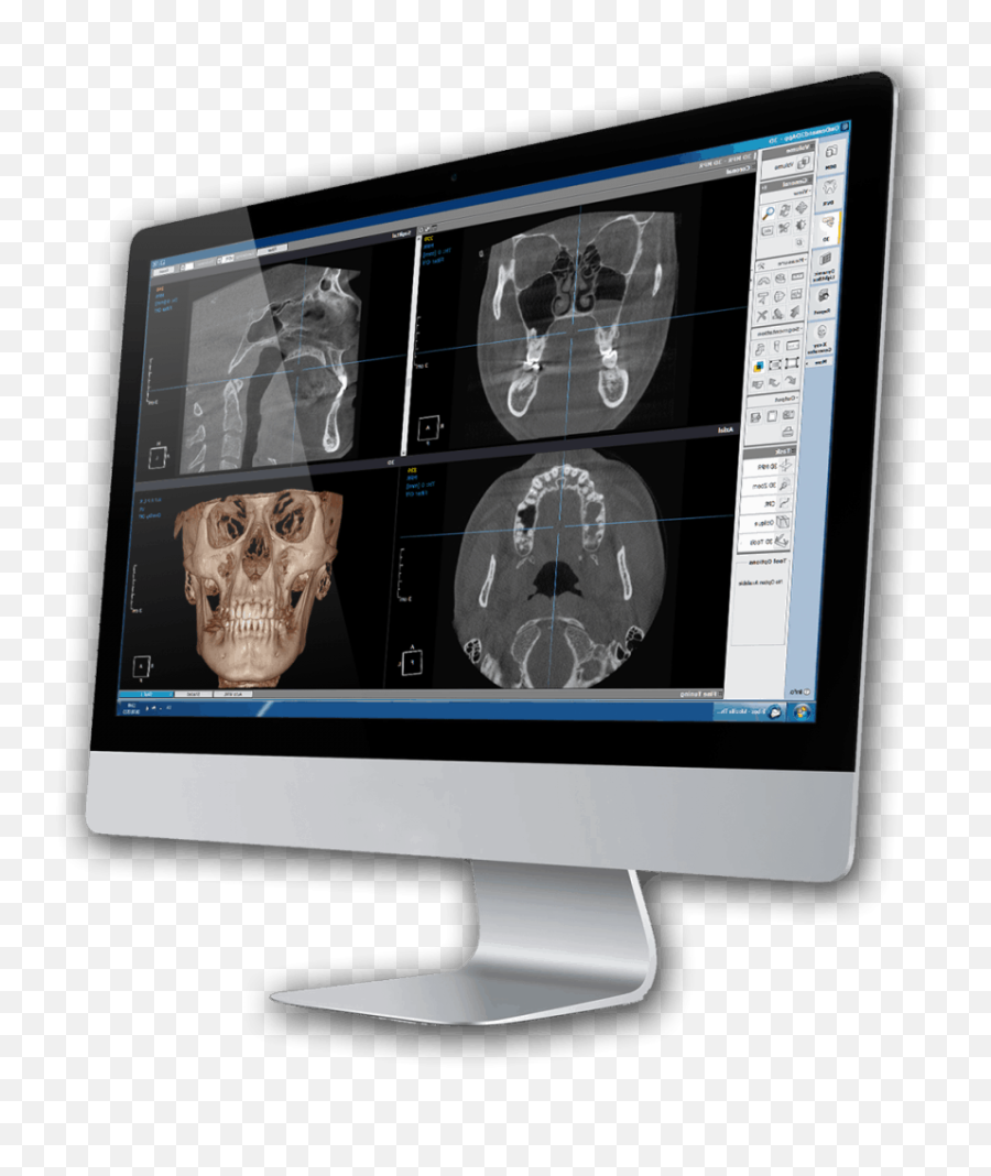 Computer Tomografie Totala Pret - Vertical Emoji,Tomografo Siemens Somatom Emotion 16