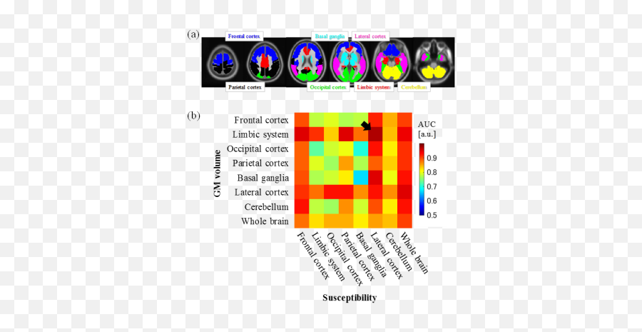 Ismrm19 Posters - Neuro Vertical Emoji,Anthony Rizzo Glass Case Of Emotion