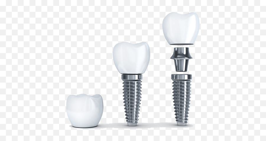 Dental Implants - Gundersen Dental Care Emoji,Light Bulb Emoticon Png Transparent Bg