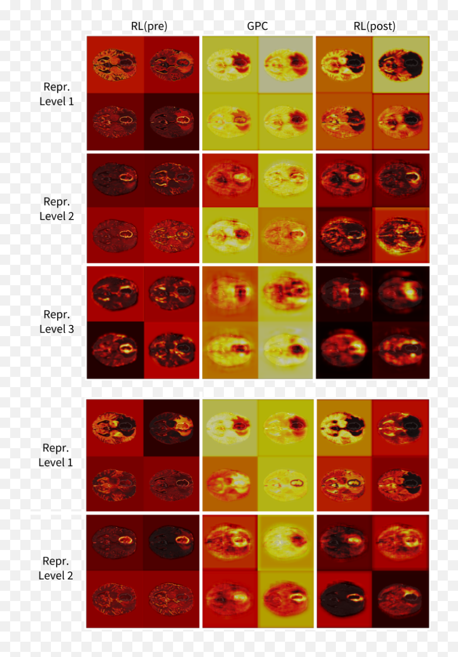 Global Planar Convolutions For Improved Context Aggregation - Language Emoji,Y U No Emoticon