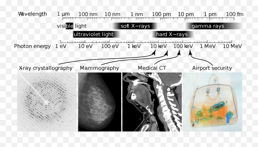 Deep Learning In Healthcare U2014 X - Ray Imaging Part 1 U2014 Basics Emoji,Work Emotion Knock Offs