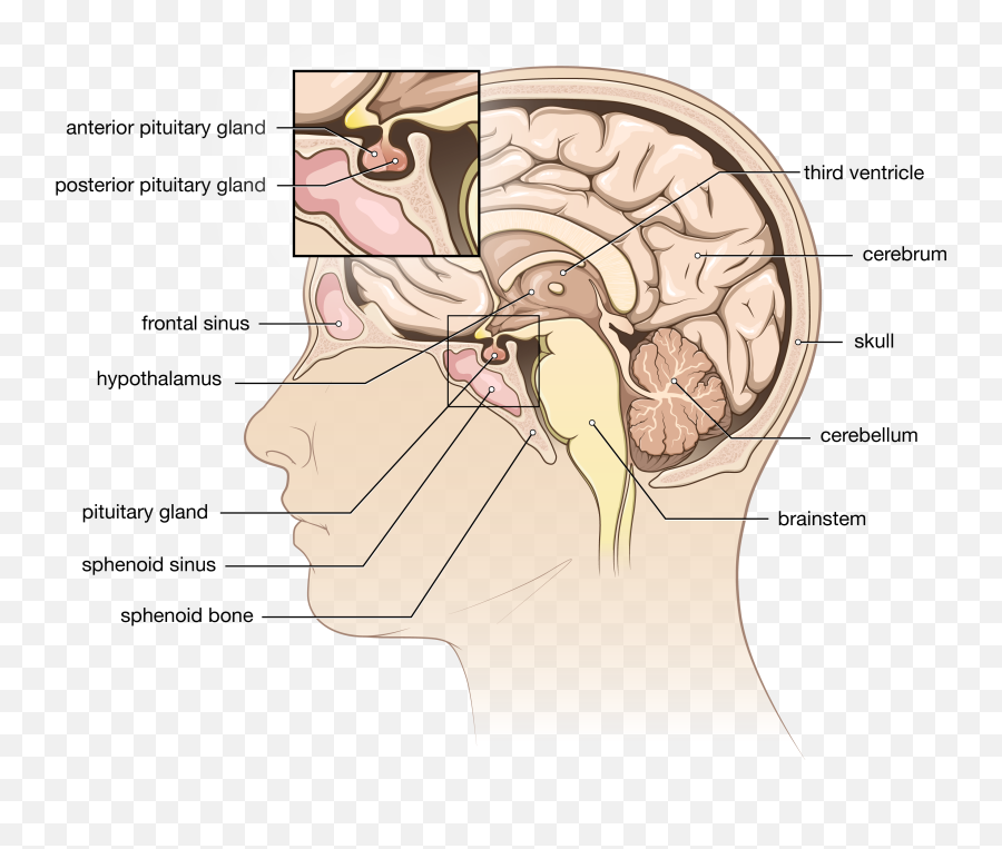 Pituitary Tumor - Pituitary Tumor Emoji,Surgery Cut Open Brain And No Emotion