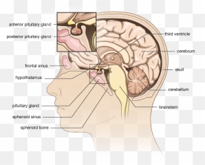 Pituitary Tumor - Pituitary Tumor Emoji,Surgery Cut Open Brain And No Emotion